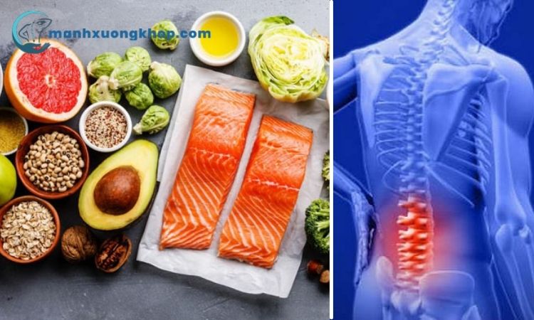 Dinh dưỡng ảnh hưởng gì đến bệnh thoái hóa cột sống lưng? 1