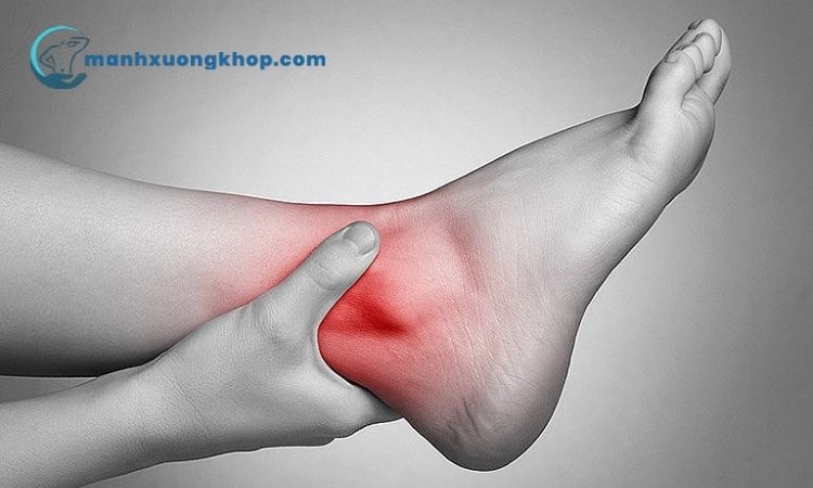 Bệnh viêm khớp cổ chân là gì? 1